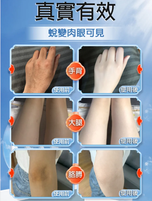 【拯救黑肌膚】火爆活動#買一贈二 全身一洗白沐浴乳!暢銷海外,全身適用,告別肌膚暗沈!夏季更要做白的出眾的仙女! 【拯救黑肌膚】火爆活動#買一贈二 全身一洗白沐浴乳!暢銷海外,全身適用,告別肌膚暗沈!夏季更要做白的出眾的仙女!